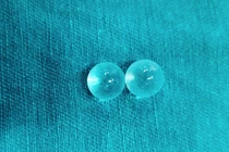 2 viên bi được cấy vào thân dương vật sát quy đầu của người bệnh. Ảnh: BVCC