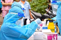 Bộ Y tế đã ban hành Thông tư quy định giá xét nghiệm SARS-CoV-2. Theo Thông tư mới này, mức giá trần mới sẽ giảm cao nhất khoảng 30% so với giá hiện hành.