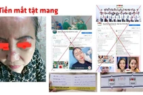 Trang facebook mạo danh Bệnh viện Trung ương Quân đội 108 khiến người dân "tiền mất, tật mang" (Ảnh - BVCC) 