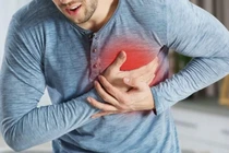 Đột quỵ ngày càng trẻ hoá (Ảnh minh hoạ) 