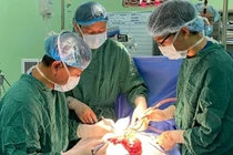 Các bác sĩ phẫu thuật loại bỏ khối u máu khổng lồ cho bệnh nhi (Ảnh: BVCC) 
