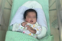 Thai nhi sinh non 31 tuần tuổi bị ngừng tim, ngừng thở đã hồi phục (Ảnh: Nguyễn Liên) 