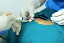 Các bác sĩ tiến hành phẫu thuật cho bệnh nhân. Ảnh: Bệnh viện E. 