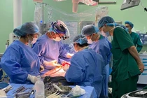 Các bác sĩ ghép gan cho bệnh nhi (Ảnh - BVCC) 