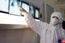 Bác sĩ chuyên khoa điều trị tại Khoa Bệnh Nhiệt đới (Bệnh viện Chợ Rẫy) - Ảnh: BVCR 