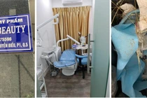 Bên dưới chung cư là biển hiệu “Công ty TNHH Mỹ phẩm Chang Beauty”, tại tầng 2 chung cư là cơ sở dịch vụ thẩm mỹ nhưng có chứng cứ của phẫu thuật thẩm mỹ trái phép (Ảnh: SYT) 
