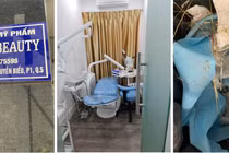 Bên dưới chung cư là biển hiệu “Công ty TNHH Mỹ phẩm Chang Beauty”, tại tầng 2 chung cư là cơ sở dịch vụ thẩm mỹ nhưng có chứng cứ của phẫu thuật thẩm mỹ trái phép (Ảnh: SYT) 