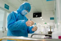 Trung tâm Y tế Vietsovpetro và Trung tâm Kiểm soát Dịch bệnh tỉnh Bà Rịa - Vũng Tàu đã lấy mẫu bệnh phẩm gửi Bệnh viện Thống Nhất, TP.HCM (Ảnh: BYT) 