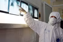 Phòng dịch COVID-19, Sở Y tế TP.HCM yêu cầu chỉ chuyển tuyến khi bệnh nhân diễn biến rất nặng, vượt quá năng lực kỹ thuật của tuyến dưới - Ảnh: BVCR 