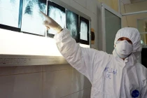 Phòng dịch COVID-19, Sở Y tế TP.HCM yêu cầu chỉ chuyển tuyến khi bệnh nhân diễn biến rất nặng, vượt quá năng lực kỹ thuật của tuyến dưới - Ảnh: BVCR 