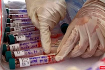 Lực lượng y tế lấy mẫu xét nghiệm SARS-CoV-2