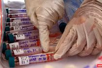 Lực lượng y tế lấy mẫu xét nghiệm SARS-CoV-2