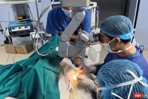 Các bác sĩ Bệnh viện Trung ương Quân đội 108đang thực hiện ca ghép giác mạc cho bệnh nhân (Ảnh BVCC)