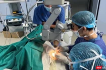 Các bác sĩ Bệnh viện Trung ương Quân đội 108đang thực hiện ca ghép giác mạc cho bệnh nhân (Ảnh BVCC)