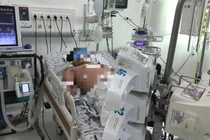 Bệnh nhân sốc sốt xuất huyết nặng điều trị tại Bệnh viện Nhi đồng Thành phố (TP HCM). Ảnh: BVCC