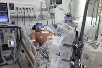 Bệnh nhân sốc sốt xuất huyết nặng điều trị tại Bệnh viện Nhi đồng Thành phố (TP HCM). Ảnh: BVCC