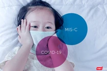 Trẻ em mắc hội chứng MIS-C cần được theo dõi chặt chẽ. Ảnh: HCDC 