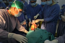 Giành lại sự sống cho nam sinh bị thanh sắt xuyên qua mặt