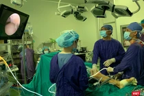 Một ca phẫu thuật thay khớp gối tại BV Việt Đức