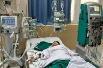 Lần đầu lọc máu liên tục cho bệnh nhi, cứu sống cháu bé 10 tuổi