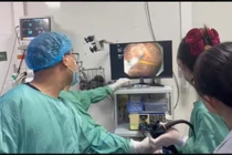 Chiếc tăm 7cm cắm sâu trong dạ dày, bệnh nhân thoát chết trong gang tấc 