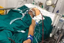 Dập nát ngực, phổi do rơi từ tầng 4, thợ xây vượt cửa tử sau 5 ngày đặt ECMO