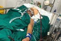 Dập nát ngực, phổi do rơi từ tầng 4, thợ xây vượt cửa tử sau 5 ngày đặt ECMO