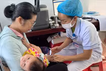 TP.HCM: Chính thức công bố dịch sởi và kế hoạch ứng phó 