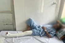 Điều tra vụ người phụ nữ tố cáo bị bảo vệ Bệnh viện K đánh gãy chân