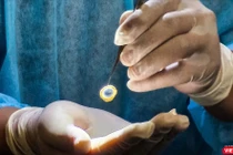 Cụ ông để lại di nguyện được hiến mô, tạng khi qua đời.