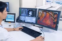 "Đau ngực đột ngột, đừng chần chừ - tín hiệu cứu mạng khi bị nhồi máu cơ tim”