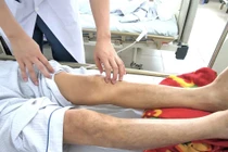 Giun chó mèo “ăn” vào não vì nuôi thú cưng bẩn, ăn uống nguy hiểm