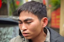 Nam shipper bị tài xế Lexus hành hung: "Tôi vẫn choáng váng, chảy máu mũi"