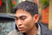 Nam shipper bị tài xế Lexus hành hung: "Tôi vẫn choáng váng, chảy máu mũi"