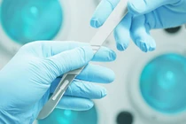 Ca phẫu thuật cấy ghép đầu được thực hiện thành công (ảnh minh họa).