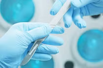 Ca phẫu thuật cấy ghép đầu được thực hiện thành công (ảnh minh họa).