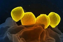 Vi khuẩn ăn thịt người dưới ống kính hiển vi (Ảnh: Singtao).