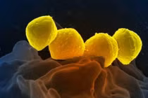 Vi khuẩn ăn thịt người dưới ống kính hiển vi (Ảnh: Singtao).