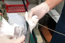 Một phần con sán dây bò được lấy ra khỏi tá tràng của bệnh nhân. Ảnh: BVCC