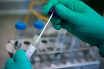 Mẫu xét nghiệm COVID-19. Ảnh: Internet