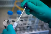 Mẫu xét nghiệm COVID-19. Ảnh: Internet