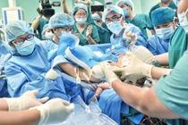 Ca phẫu thuật tách cặp song sinh Trúc Nhi - Diệu Nhi (Ảnh: Duyên Phan)