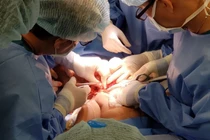 Gần 100 bác sĩ tham gia ca đại phẫu tách rời hai bé Trúc Nhi - Diệu Nhi (Ảnh: BVCC)