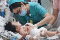 Bé M. phải thở máy vì ngộ độc nitrite. Ảnh- BVCC