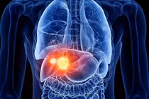 Các nhà khoa học UC San Diego tìm thấy protein ATF4 ngăn ngừa tổn thương gan và sự tiến triển thành ung thư Ảnh: UC San Diego