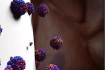 Xạ trị bằng hạt Alpha DaRT tiêu diệt tế bào ung thư. Ảnh Courtesy