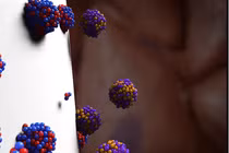 Xạ trị bằng hạt Alpha DaRT tiêu diệt tế bào ung thư. Ảnh Courtesy