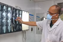 PGS.TS. Nguyễn Hồng Hà - Trưởng khoa Phẫu thuật Hàm mặt, Tạo hình và Thẩm mỹ, Bệnh viện Hữu nghị Việt Đức chẩn đoán hình ảnh bệnh lý của bệnh nhân