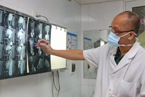 PGS.TS. Nguyễn Hồng Hà - Trưởng khoa Phẫu thuật Hàm mặt, Tạo hình và Thẩm mỹ, Bệnh viện Hữu nghị Việt Đức chẩn đoán hình ảnh bệnh lý của bệnh nhân