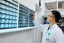 BSCKII Thân Trọng Vũ - Trưởng khoa Ngoại lồng ngực, Bệnh viện Đà Nẵng, phẫu thuật viên chính của ê kíp mổ - chẩn đoán hình ảnh của bệnh nhân